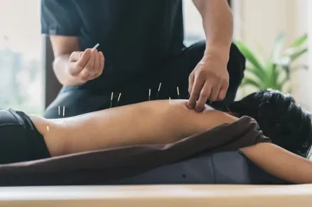 A person is getting acupuncture on his leg.