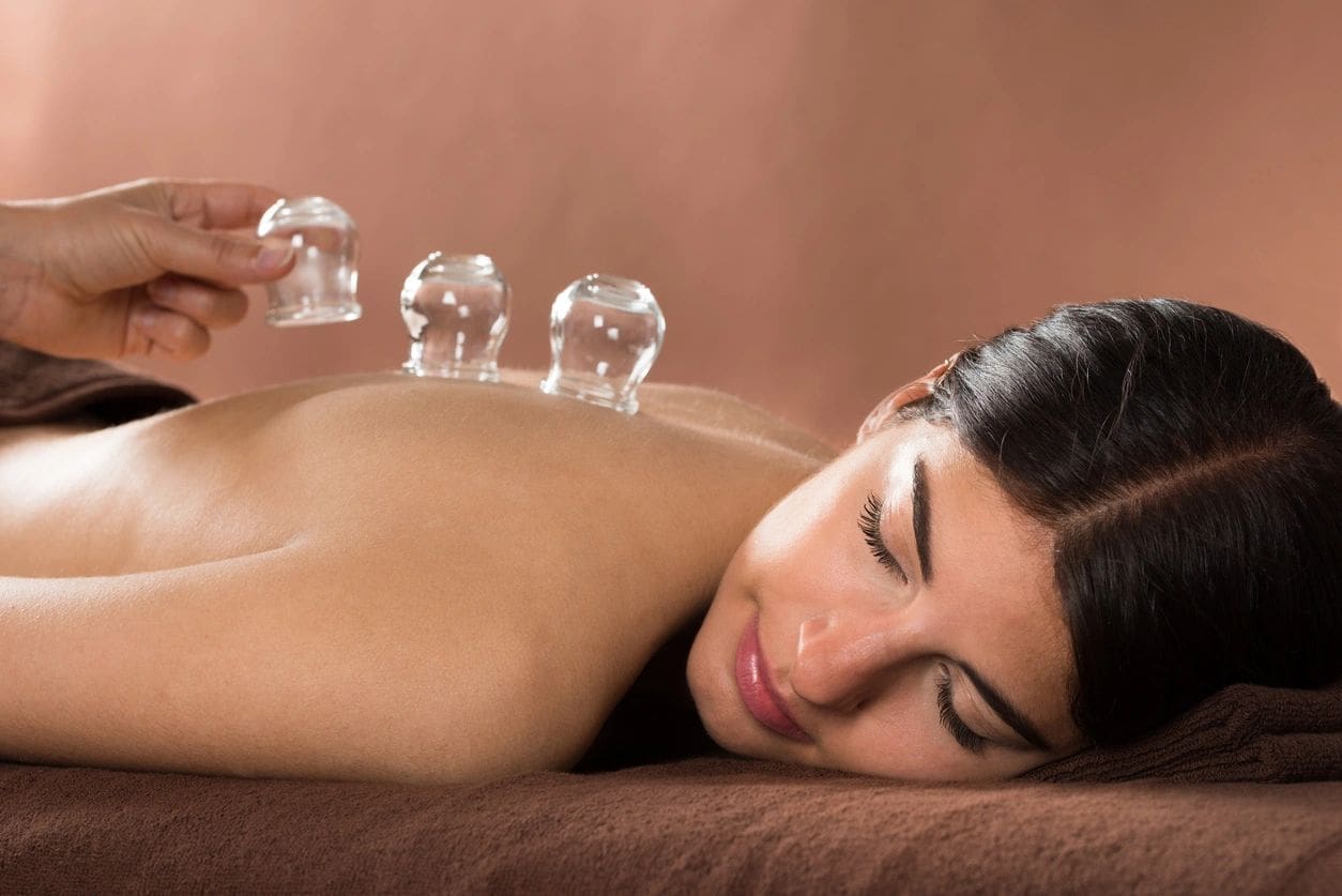 A woman laying down with cupping cups on her back.