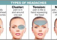 Different types of headaches illustrated on a female head.